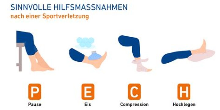 Was macht man bei einer Verstauchung?